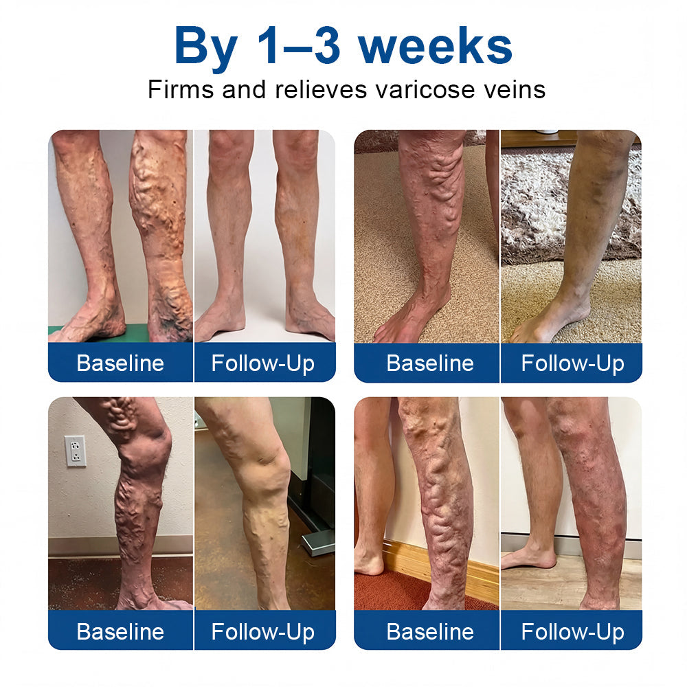 🇨🇦👨‍⚕️👍✅𝐂𝐚𝐫𝐞𝐔𝐩𝐥𝐢𝐟𝐭® VeinTarget Microneedle Patch⚡Instant Relief, Long-Term Results