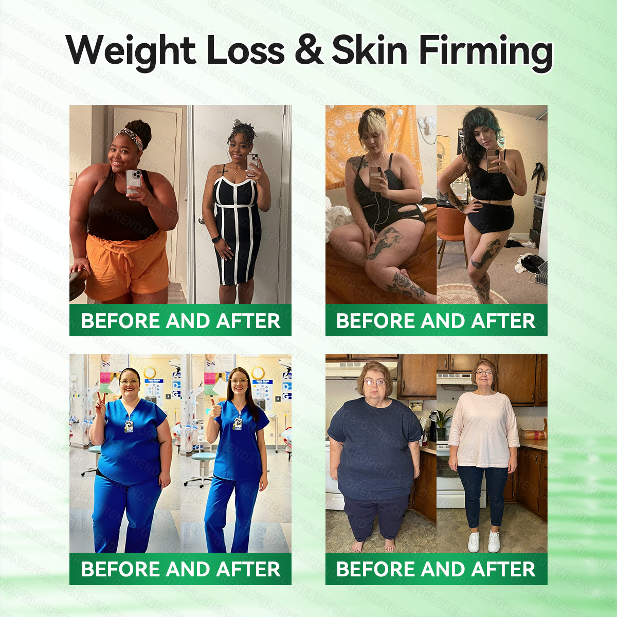 🇨🇦𝑶𝒇𝒇𝒊𝒄𝒊𝒂𝒍 𝑺𝒕𝒐𝒓𝒆  | 💖 𝐂𝐚𝐫𝐞𝐔𝐩𝐥𝐢𝐟𝐭® 𝙈𝒐𝒓𝒊𝒏𝒈𝗮 · 𝗕𝗲𝗿𝗯𝐞𝐫𝐢𝐧𝙚 × 𝙉𝑨𝑫+ 𝟏𝟎-𝙞𝙣-𝟏 𝘼𝒅𝒗𝒂𝒏𝒄𝒆𝐝 𝐍𝐚𝐧𝙤 𝙈𝙞𝙘𝙧𝙤𝙣𝒆𝒆𝒅𝒍𝐞 𝐏𝐚𝐭𝙘𝙝(𝐉𝐮𝐬𝐭 𝐨𝐧𝐜𝐞 𝐚 𝐝𝐚𝐲, 𝐯𝐢𝐬𝐢𝐛𝐥𝐞 𝐜𝐡𝐚𝐧𝐠𝐞𝐬 𝐢𝐧 𝟕 𝐝𝐚𝐲𝐬） ✅ 𝐅𝐨𝐫 𝐨𝐛𝐞𝐬𝐢𝐭𝐲, 🅛🅞🅞🅢🅔 🅢🅚🅘🅝,𝐝𝐢𝐚𝐛𝐞𝐭𝐞𝐬, 𝐬𝐥𝐞𝐞𝐩 𝐚𝐩𝐧𝐞𝐚, 𝐣𝐨𝐢𝐧𝐭 𝐢𝐬𝐬𝐮𝐞𝐬, 𝐚𝐧𝐝 𝐦𝐨𝐫𝐞