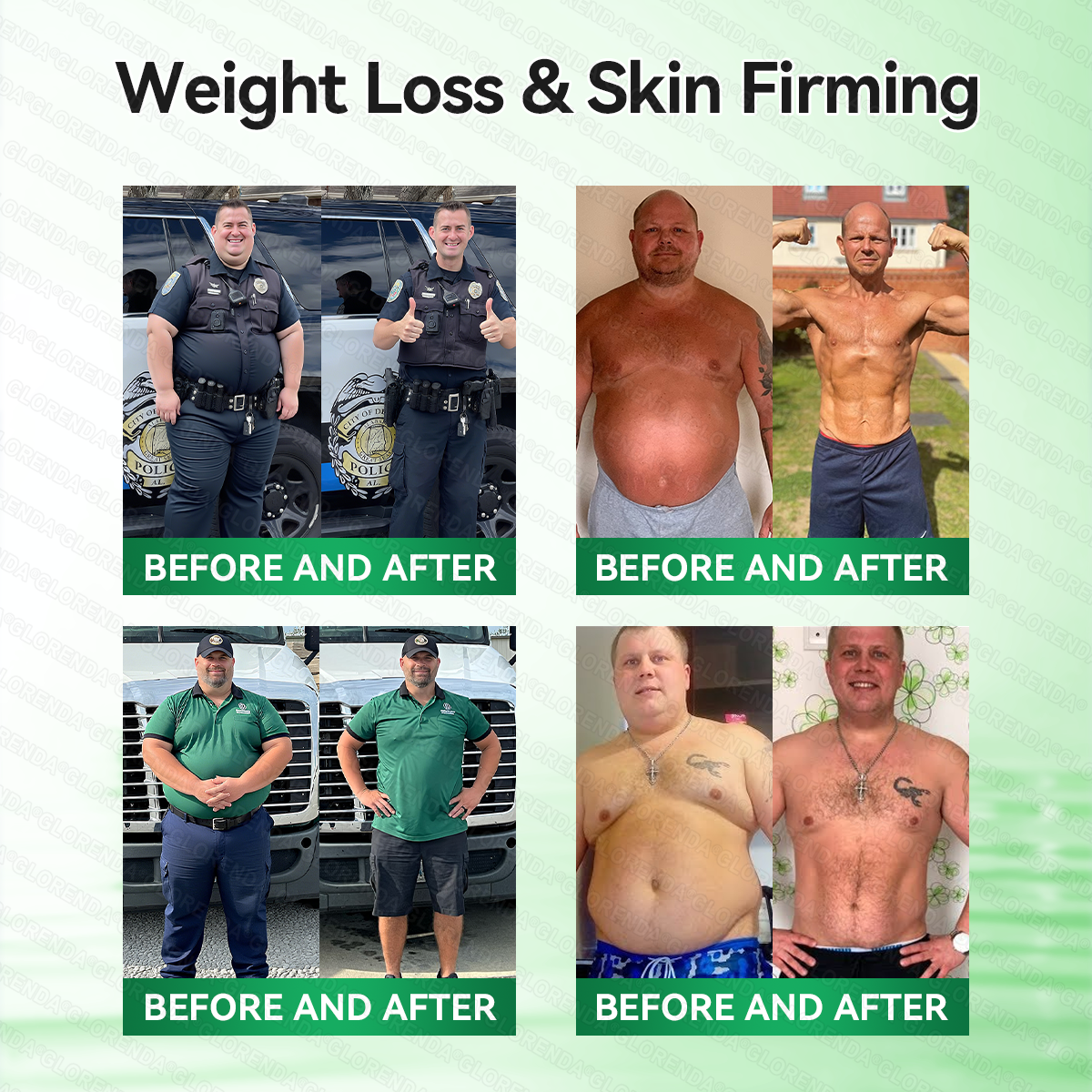 🇨🇦𝑶𝒇𝒇𝒊𝒄𝒊𝒂𝒍 𝑺𝒕𝒐𝒓𝒆  | 💖 𝐂𝐚𝐫𝐞𝐔𝐩𝐥𝐢𝐟𝐭® 𝙈𝒐𝒓𝒊𝒏𝒈𝗮 · 𝗕𝗲𝗿𝗯𝐞𝐫𝐢𝐧𝙚 × 𝙉𝑨𝑫+ 𝟏𝟎-𝙞𝙣-𝟏 𝘼𝒅𝒗𝒂𝒏𝒄𝒆𝐝 𝐍𝐚𝐧𝙤 𝙈𝙞𝙘𝙧𝙤𝙣𝒆𝒆𝒅𝒍𝐞 𝐏𝐚𝐭𝙘𝙝(𝐉𝐮𝐬𝐭 𝐨𝐧𝐜𝐞 𝐚 𝐝𝐚𝐲, 𝐯𝐢𝐬𝐢𝐛𝐥𝐞 𝐜𝐡𝐚𝐧𝐠𝐞𝐬 𝐢𝐧 𝟕 𝐝𝐚𝐲𝐬） ✅ 𝐅𝐨𝐫 𝐨𝐛𝐞𝐬𝐢𝐭𝐲, 🅛🅞🅞🅢🅔 🅢🅚🅘🅝,𝐝𝐢𝐚𝐛𝐞𝐭𝐞𝐬, 𝐬𝐥𝐞𝐞𝐩 𝐚𝐩𝐧𝐞𝐚, 𝐣𝐨𝐢𝐧𝐭 𝐢𝐬𝐬𝐮𝐞𝐬, 𝐚𝐧𝐝 𝐦𝐨𝐫𝐞