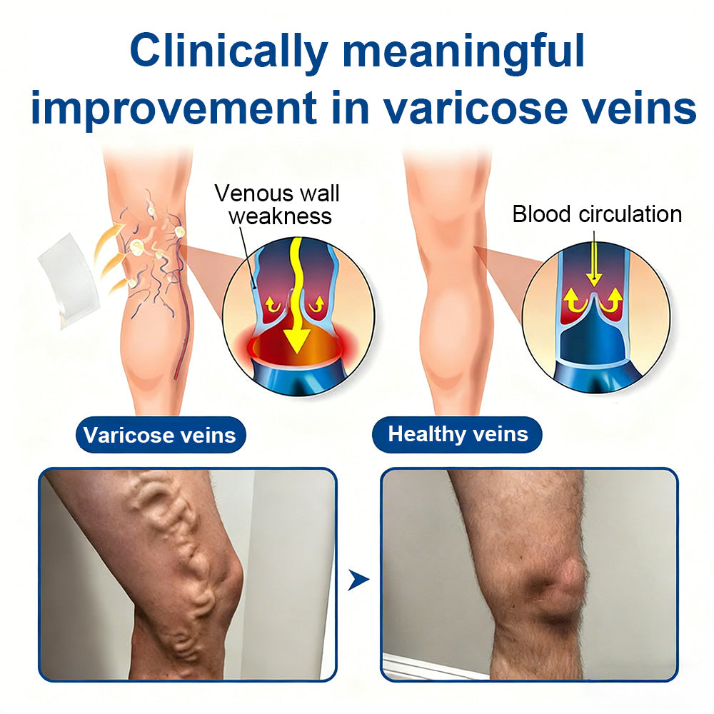 🇨🇦👨‍⚕️👍✅𝐂𝐚𝐫𝐞𝐔𝐩𝐥𝐢𝐟𝐭® VeinTarget Microneedle Patch⚡Instant Relief, Long-Term Results