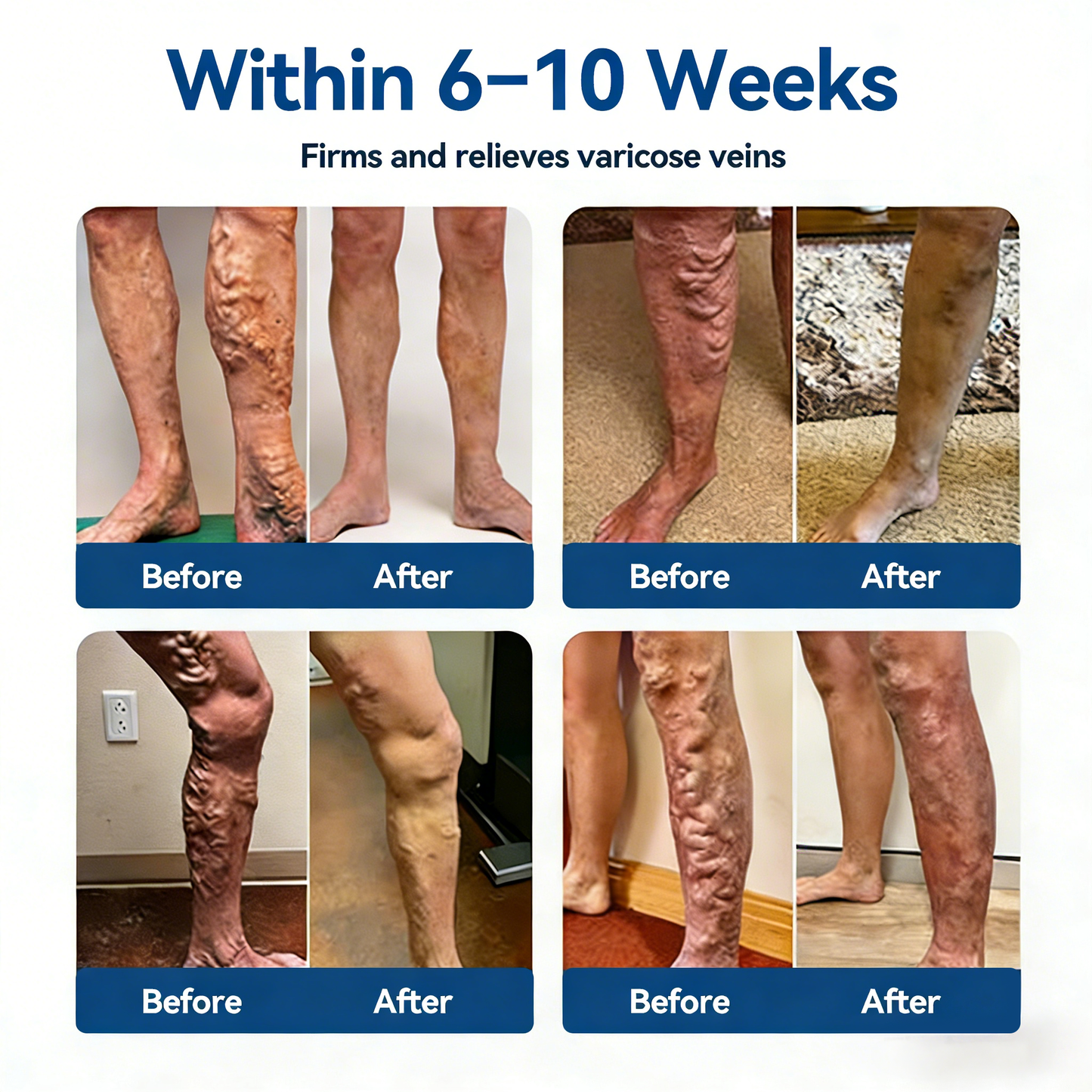 𝓞𝒇𝒇𝙞𝒄𝙞𝒂𝒍 𝑺𝒕𝙤𝒓𝓮 |🛡️𝐂𝐚𝐫𝐞𝐔𝐩𝐥𝐢𝐟𝐭® 𝐃𝗹𝐎𝐒𝐌𝗹𝐍 & 𝐇𝐄𝐒𝐏𝐄𝐑𝗹𝐃𝗹𝐍 𝐂𝗹𝐢𝐧𝐢𝐜𝐚𝗹-𝐆𝐫𝐚𝐝𝗲 𝐅𝐨𝐫𝐦𝐮𝗹𝐚 𝐌𝐢𝐜𝐫𝐨𝐧𝗲𝗲𝐝𝗹𝐞 𝐏𝙖𝐭𝐜𝐡🔹𝗔𝗱𝘃𝗮𝗻𝗰𝗲𝗱 𝗛𝗲𝗿𝗯𝗮𝗹 𝗕𝗹𝗲𝗻𝗱 𝗧𝗮𝗿𝗴𝗲𝘁𝘀 𝗦𝗽𝗶𝗱𝗲𝗿 𝗩𝗲𝗶𝗻𝘀 & 𝗥𝗲𝗹𝗶𝗲𝘃𝗲𝘀 𝗛𝗲𝗮𝘃𝘆, 𝗧𝗶𝗿𝗲𝗱 𝗟𝗲𝗴𝘀